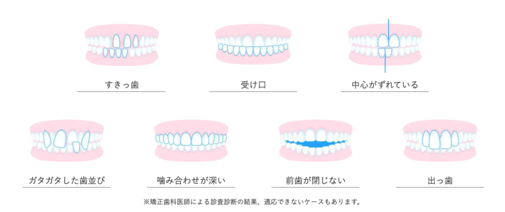 口コミ 効果は ウィ スマイル矯正の評判から矯正の流れまで徹底解説 美容マガジン